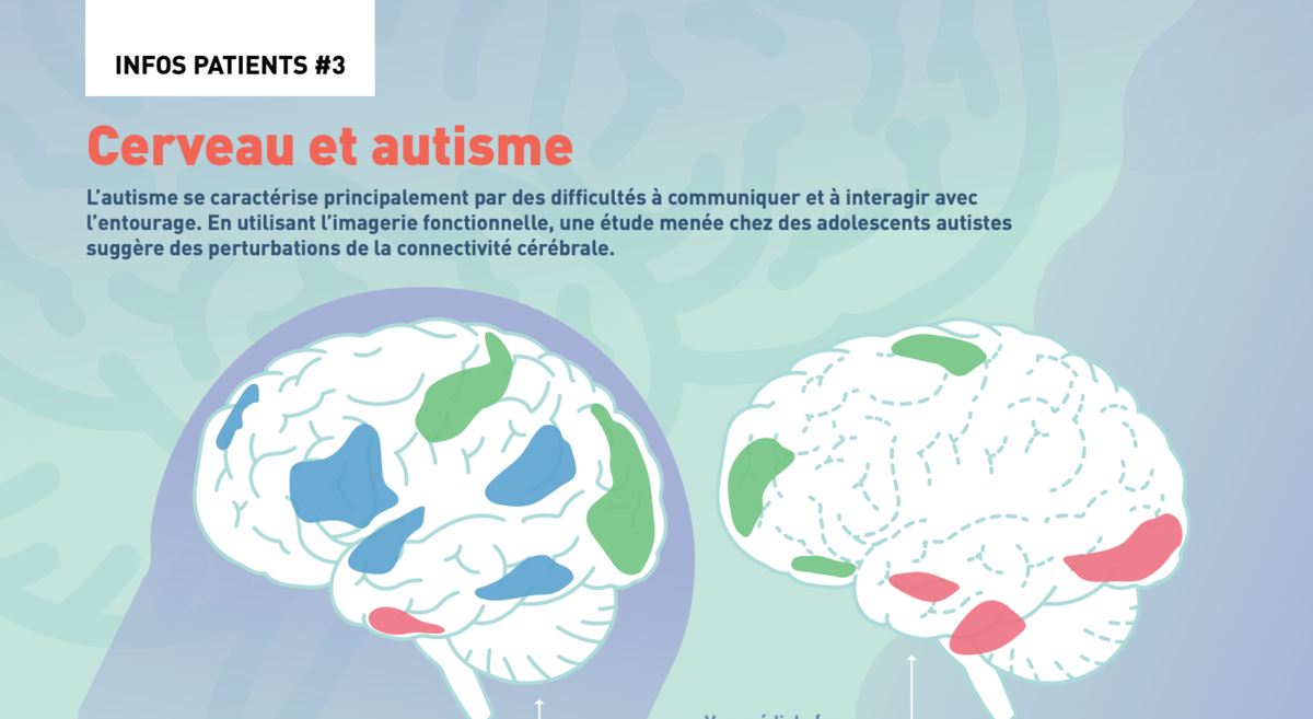 Cerveau et Autisme - Inforgraphie
