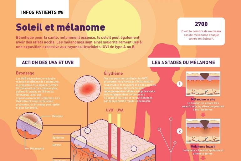 Mélanome - infographie